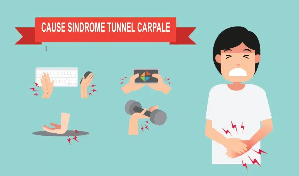 Infografica cause sindrome tunnel carpale