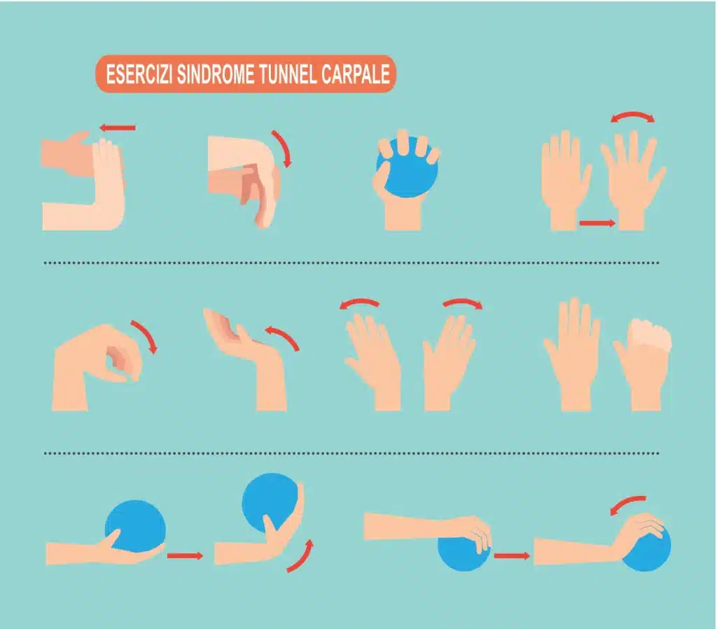 Infografica con esercizi per sindrome tunnel carpale